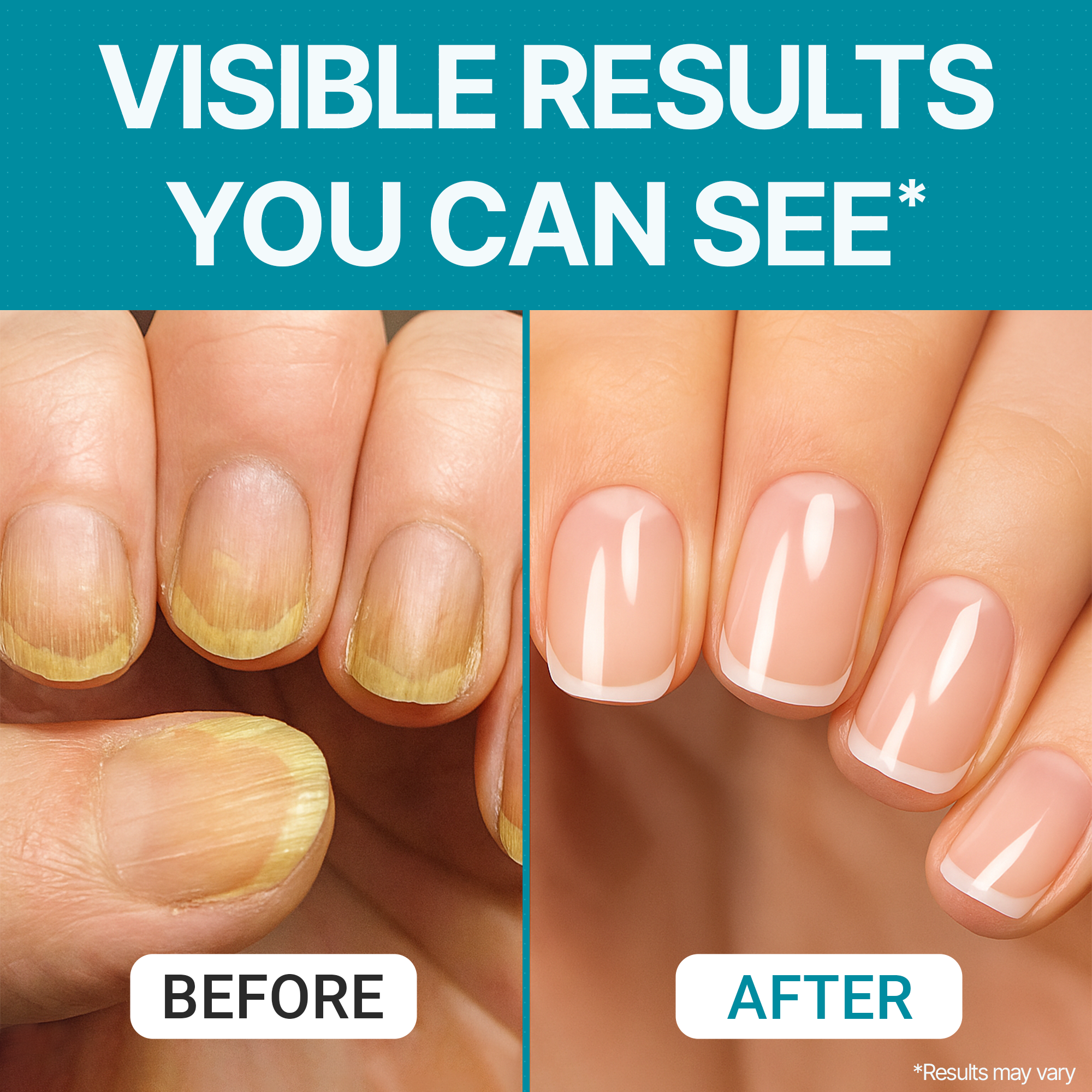 Triple Clear HF — Advanced Nail Treatment